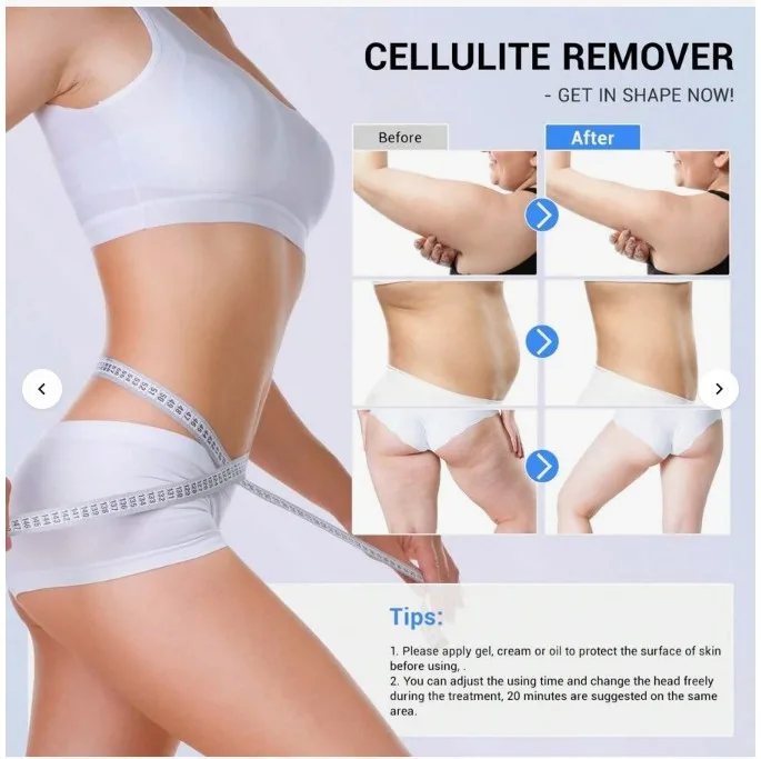 Demonstration of how the Ultrasonic Cavitation Slimming & Skin Tightening Machine changes the contours of your body.
